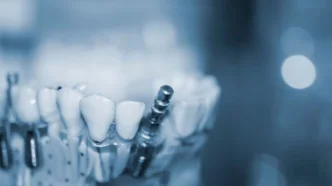 임플란트 수출 데이터, 오스템임플란트 상폐 후 대안은? 관세청 데이터로 분석 7