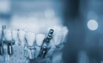 임플란트 수출 데이터, 오스템임플란트 상폐 후 대안은? 관세청 데이터로 분석 5