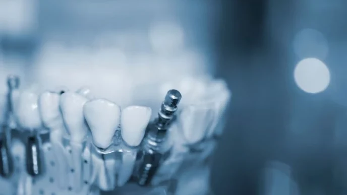 임플란트 수출 데이터, 오스템임플란트 상폐 후 대안은? 관세청 데이터로 분석 35