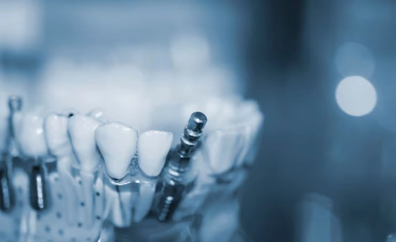 국내 치과 임플란트 시장 성장 추이 그래프