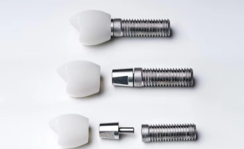 흰색 배경에 놓인 치과 임플란트