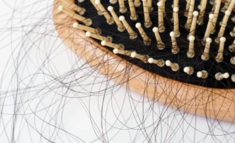 탈모 치료제 관련주, 건강보험 적용 이슈와 샴푸 시장 점유율, 급변하는 시장 속 투자 기회 포착 전략 1